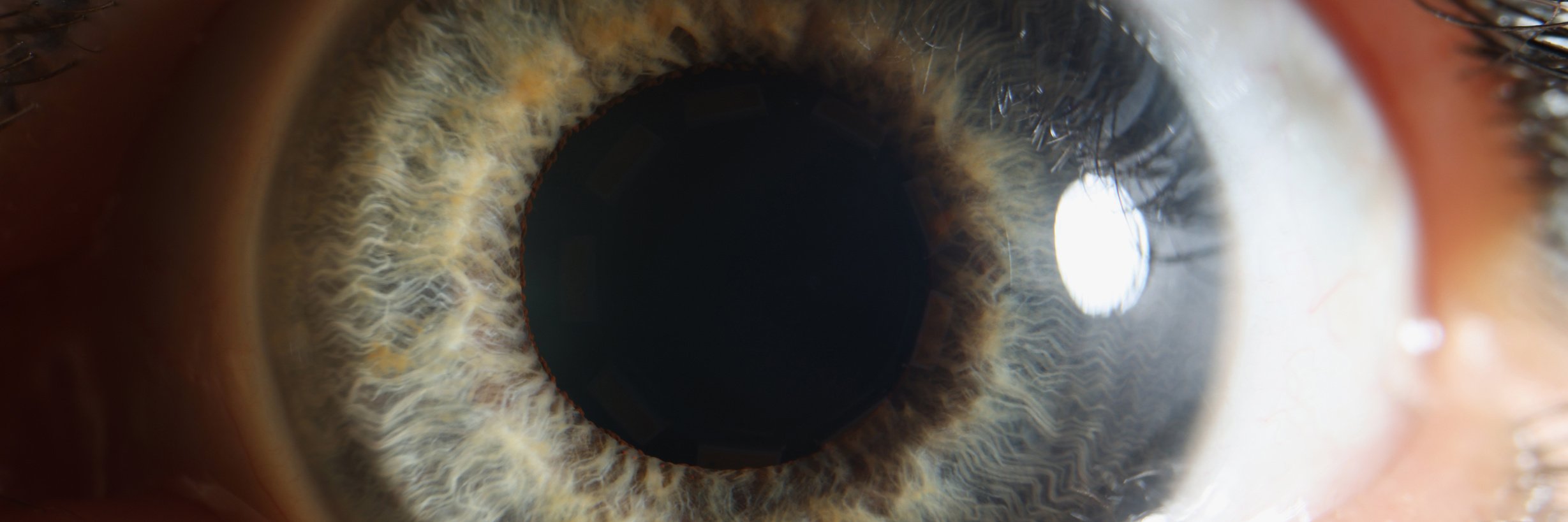 Macro Human Eye, Dilated Pupil of Gray Color, Close-up Retina